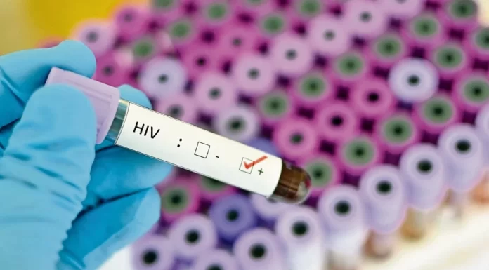 Primera mujer curada del VIH con células madre de cordón umbilical