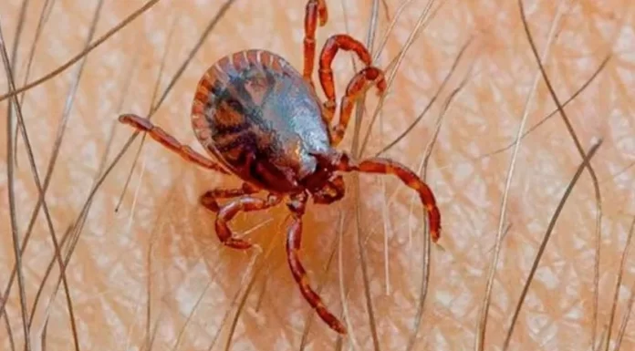 Fallecen dos por rickettsia en Cajeme