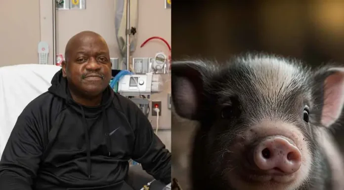 Dan de alta a hombre que recibió riñón de cerdo genéticamente modificado en un trasplante