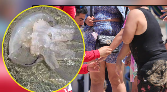 Casi 150 picaduras de agua mala fueron atendidas en Semana Santa