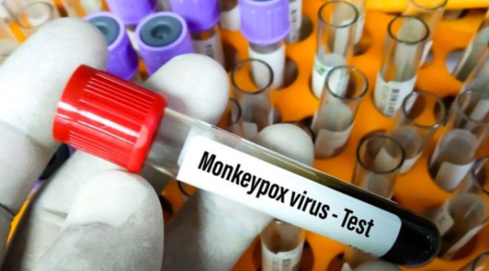 Ya no hay casos de viruela del mono en Sonora